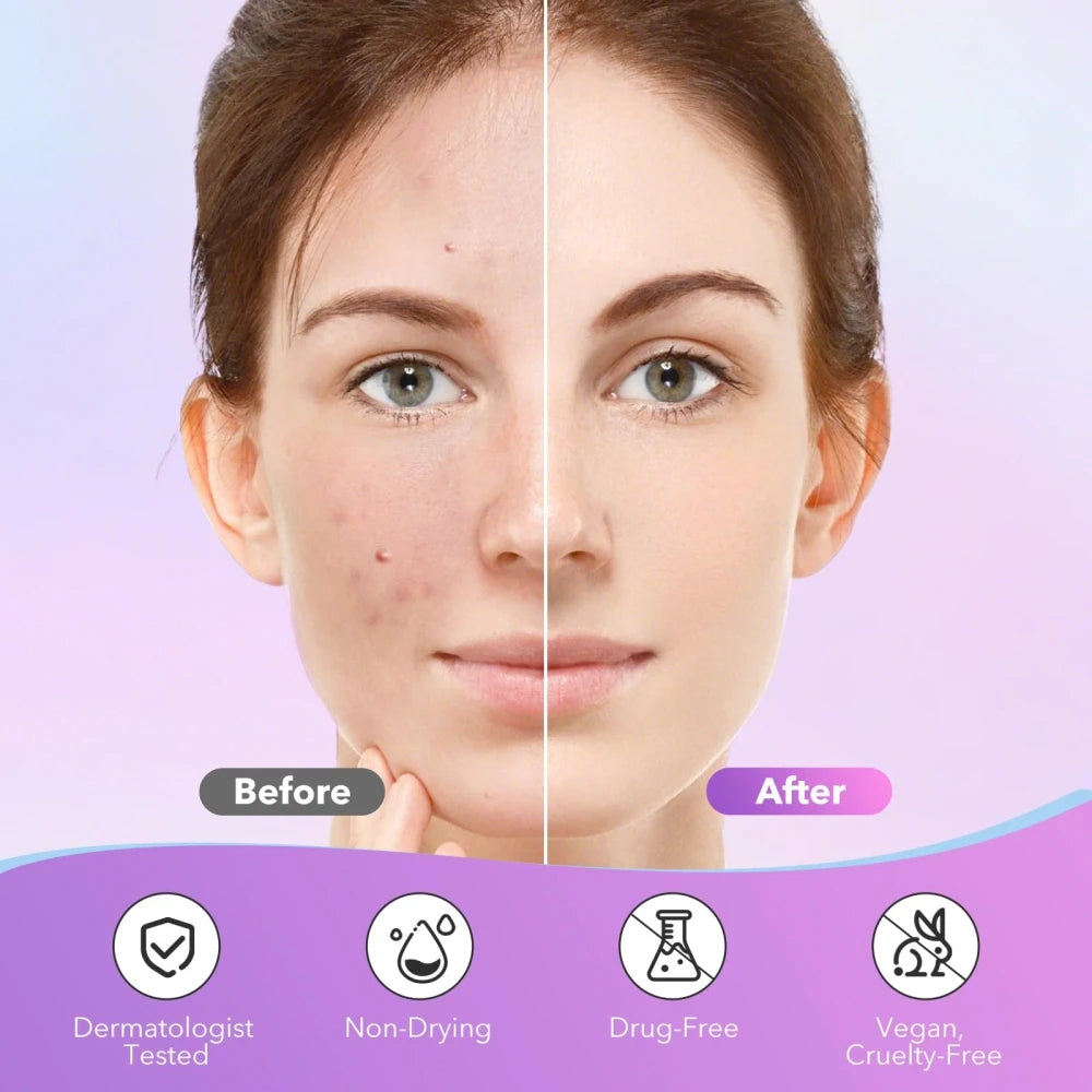 Star Shape Acne Patch Set
